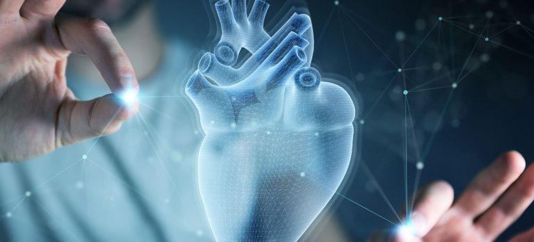 Cardiac Imaging
