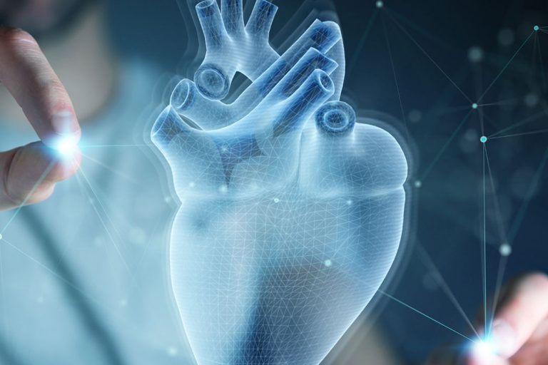 Cardiac Imaging